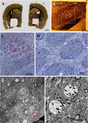 Axon terminal hypertrophy of striatal projection neurons with levodopa-induced dyskinesia priming
